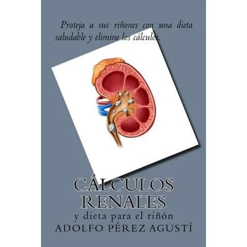 Cálculos renales: y dieta para el riñón - Paperback