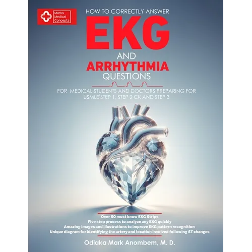 How to Correctly Answer EKG and Arrhythmia Questions: For Medical Students and Doctors Preparing for USMLE Step 1, Step 2 CK, and Step 3 - Paperback
