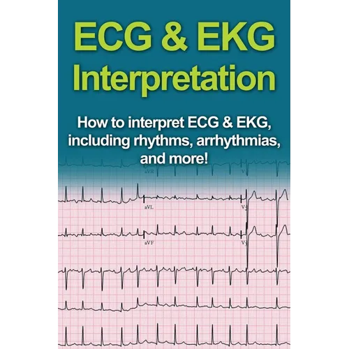 ECG & EKG Interpretation: How to interpret ECG & EKG, including rhythms, arrhythmias, and more! - Paperback