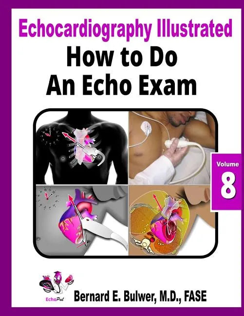 How to Do an Echo Exam - Paperback