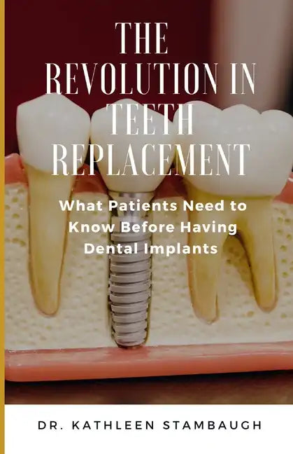 The Revolution in Teeth Replacement: What Patients Need to Know Before Having Dental Implants - Paperback