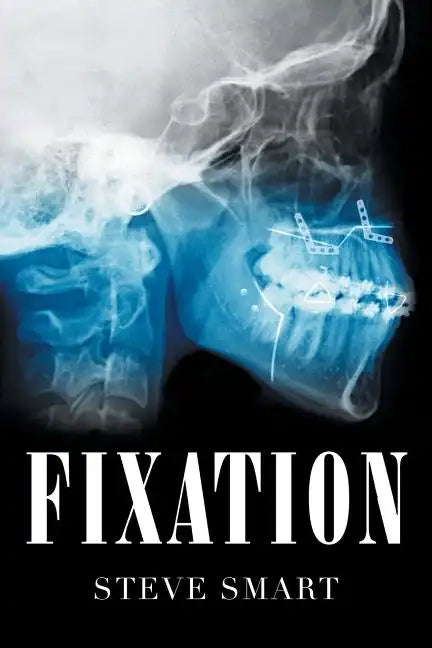 Fixation - Paperback