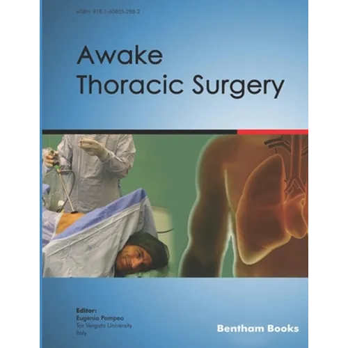 Awake Thoracic Surgery - Paperback