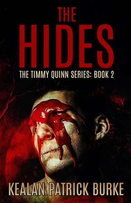 The Hides - Paperback