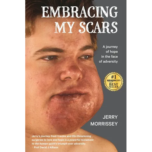 Embracing My Scars: A journey of hope in the face of adversity - Paperback