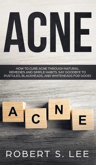 Acne: How to Cure Acne through Natural Remedies and Simple Habits. Say Goodbye to Pustules, Blackheads and Whiteheads for Good! - Hardcover