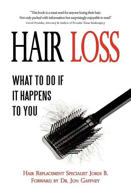 Hair Loss: What to do if it Happens to You - Hardcover