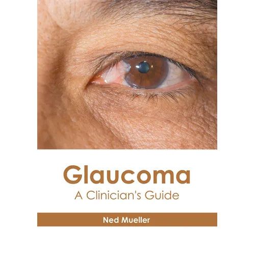 Glaucoma: A Clinician's Guide - Hardcover