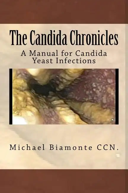 The Candida Chronicles: A Mannual for Candida/Yeast Infections - Paperback