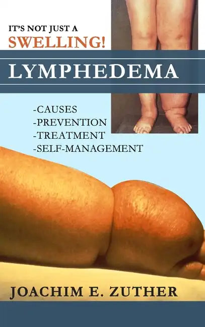 It's Not Just a Swelling! Lymphedema: Causes, Prevention, Treatment, Self-Management - Hardcover