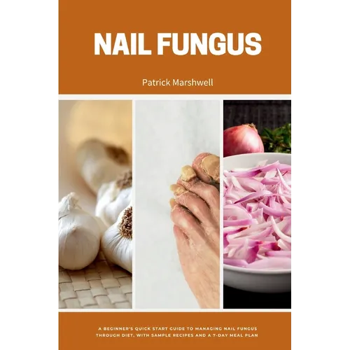 Nail Fungus: A Beginner's Quick Start Guide to Managing Nail Fungus Through Diet, With Sample Recipes and a 7-Day Meal Plan - Paperback