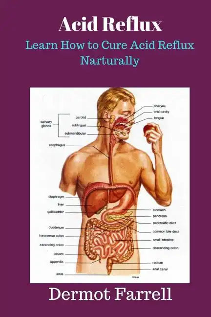 Acid Reflux: Learn How to Cure Acid Reflux Naturally - Paperback