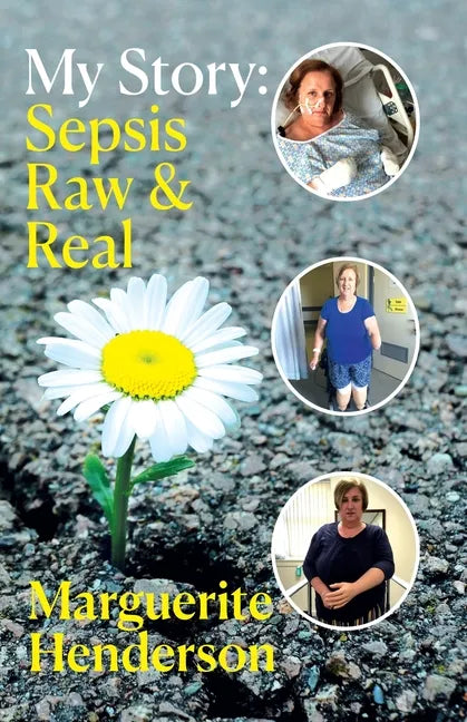 My Story: Sepsis Raw and Real - Paperback