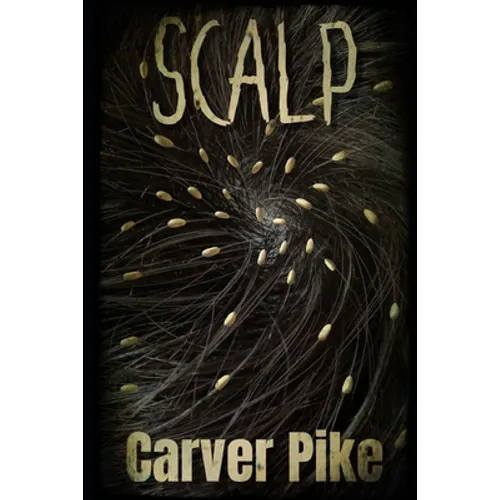 Scalp - Paperback