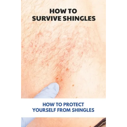 How To Survive Shingles: How To Protect Yourself From Shingles: How To Speed Up Shingles Recovery - Paperback