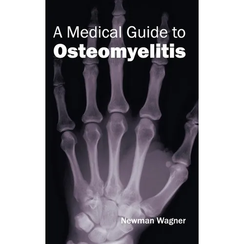 Medical Guide to Osteomyelitis - Hardcover