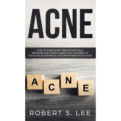 Acne: How to Cure Acne through Natural Remedies and Simple Habits. Say Goodbye to Pustules, Blackheads and Whiteheads for Good! - Hardcover