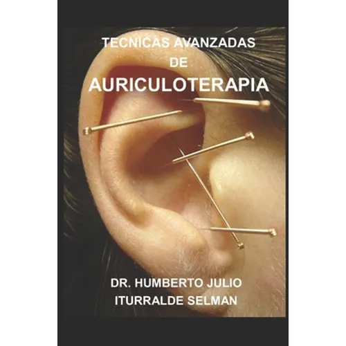 Tecnicas Avanzadas de Auriculoterapia - Paperback