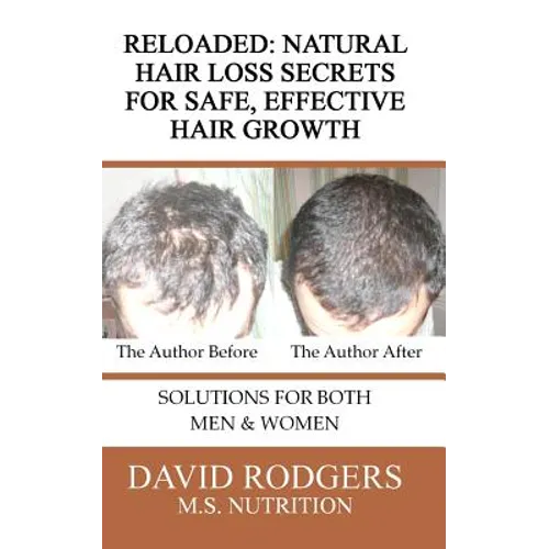 Reloaded: Natural Hair Loss Secrets for Safe, Effective Hair Growth - Paperback