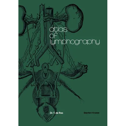Atlas of Lymphography - Paperback