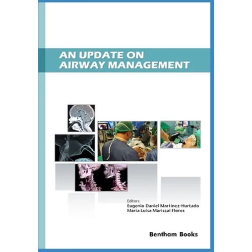 An Update on Airway Management - Paperback