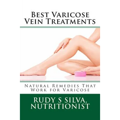 Best Varicose Vein Treatments: Natural Remedies That Work For Varicose - Paperback