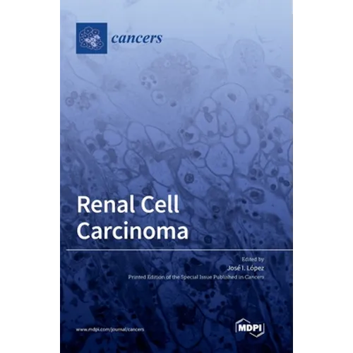 Renal Cell Carcinoma - Hardcover