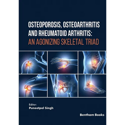 Osteoporosis, Osteoarthritis and Rheumatoid Arthritis: An Agonizing Skeletal Triad - Paperback