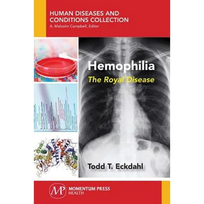 Hemophilia: The Royal Disease - Paperback