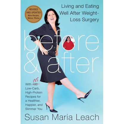 Before & After, Revised Edition (Revised) - Paperback