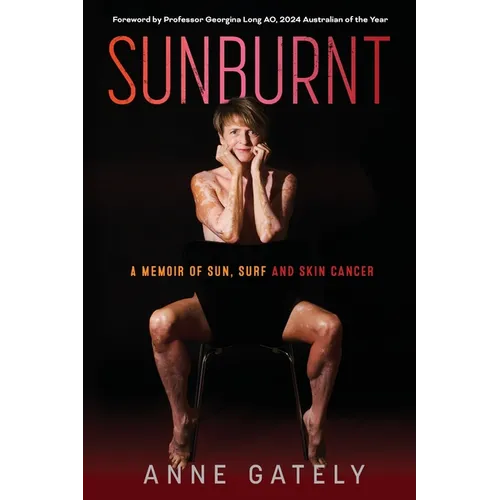 Sunburnt: A memoir of sun, surf and skin cancer - Paperback