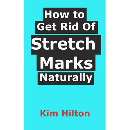 How to Get Rid Of Stretch Marks Naturally - Paperback